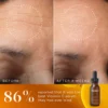 Medik8 C-Tetra Luxe Before & After