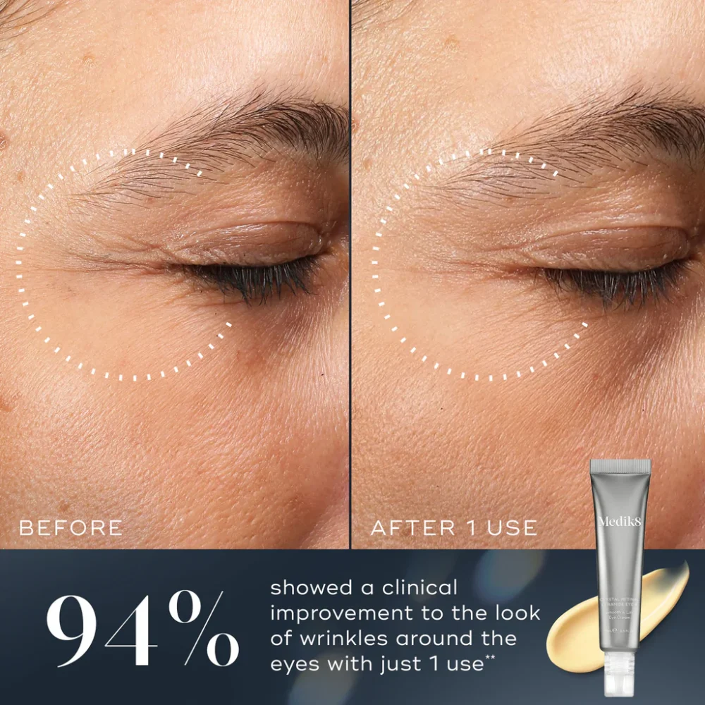 Medik8 Crystal Retinal Eye 6 Before & After