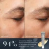 Medik8 Crystal Retinal Eye 6 Before & After