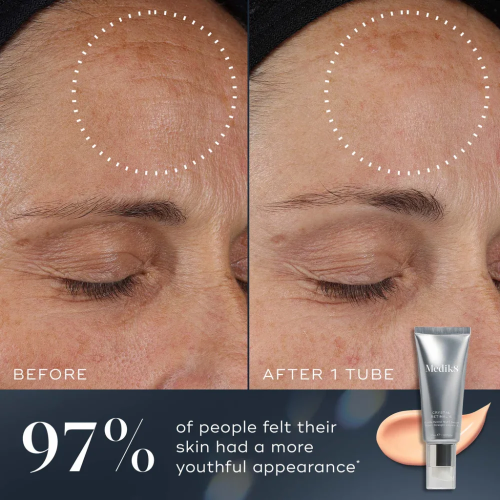 Medik8 Crystal Retinal 3 Before & After Results