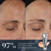 Medik8 Crystal Retinal 3 Before & After Results