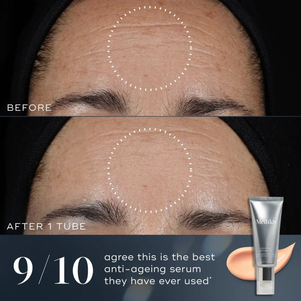 Medik8 Crystal Retinal 3 Before & After Anti Ageing Benefits