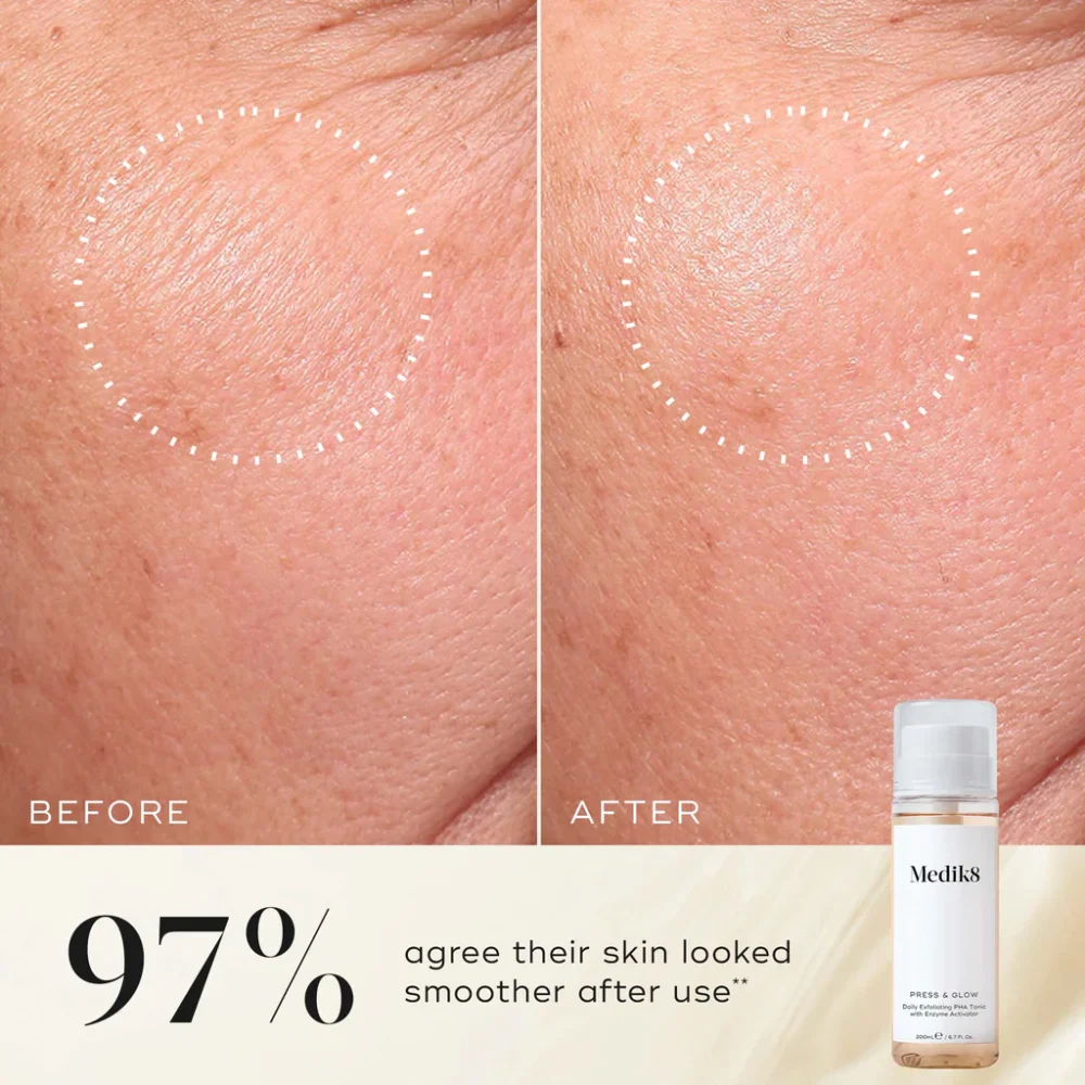 Medik8 Press & Glow Before & After