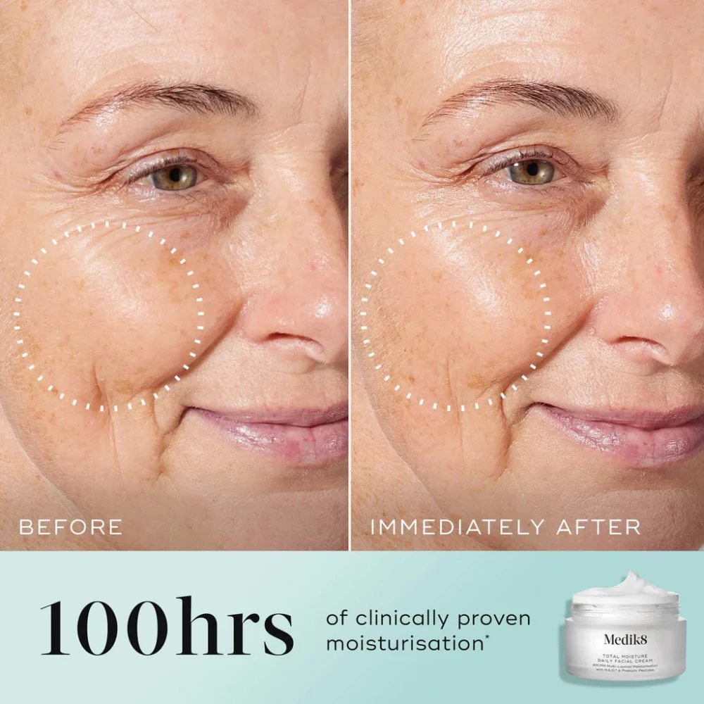 Medik8 Total Moisture Daily Facial Cream Visible Results Before & After