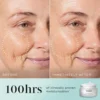 Medik8 Total Moisture Daily Facial Cream Visible Results Before & After